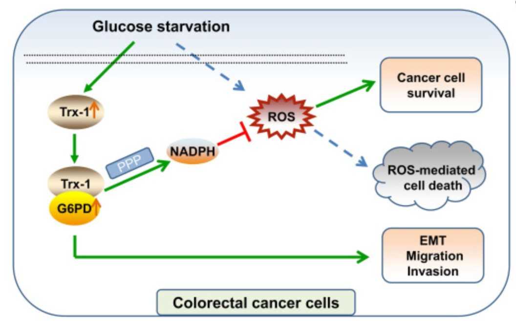 A schematic diagram showing that Trx-1 supports colorectal cancer cell survival.jpg